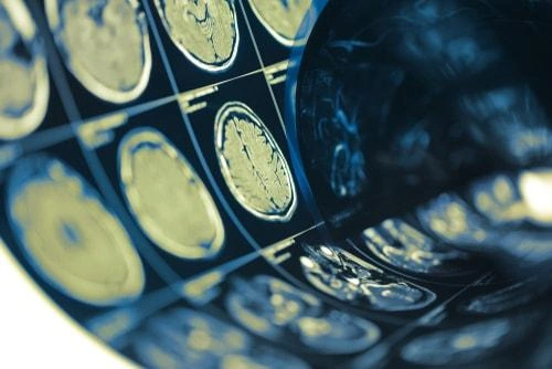 Concussion After Your Illinois Image